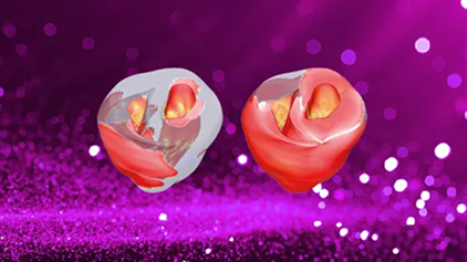 Case Study: Computational Cardiology Research